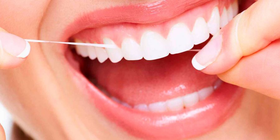clareamento-dental